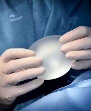 news_anti-trends_in_plastic_surgeries
